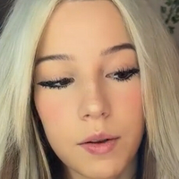 angiedemko1 Çıplak