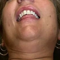 prairiepeach Çıplak