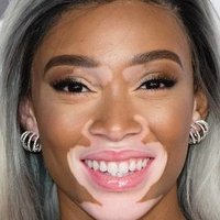 Winnie Harlow Çıplak